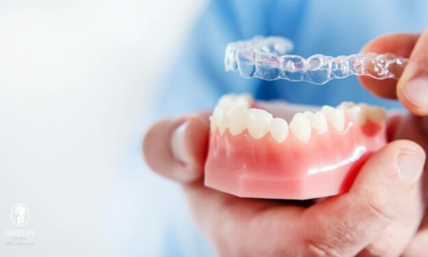 Invisalign in Scottsdale