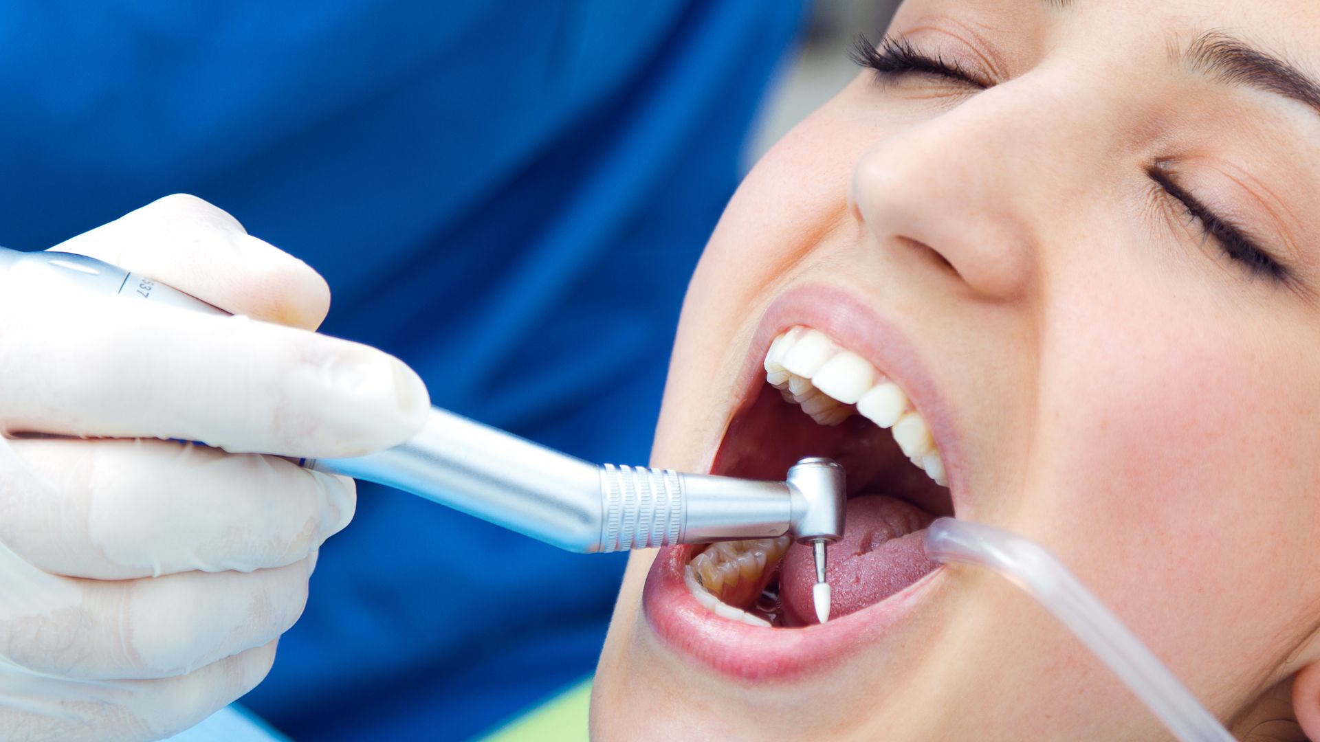 Teeth Whitening Scottsdale