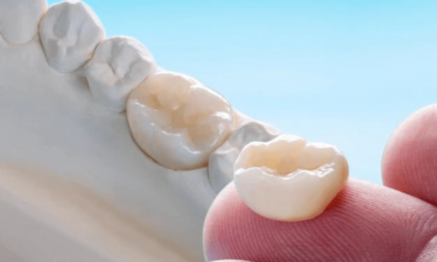 Dental Crowns Scottsdale