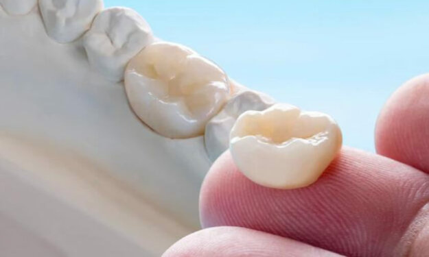 Dental Crowns Scottsdale