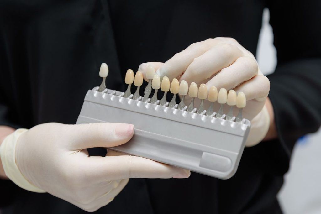 Dentist holding a veneer shade guide comparing composite and porcelain veneer shells in Scottsdale