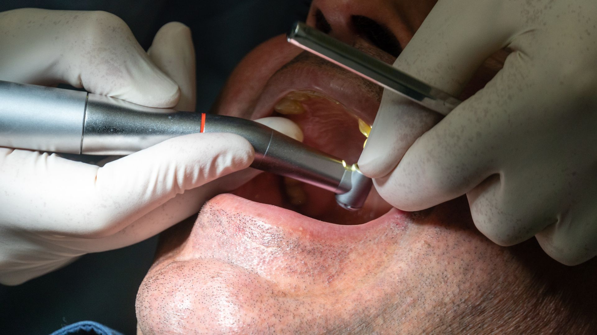 Dental Implants in Scottsdale AZ