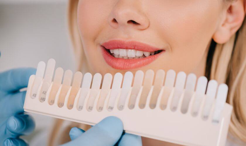 Tooth Whitening