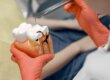 Dentist in gloved hands holding dental model showing tooth structure and gum tissue during patient consultation.