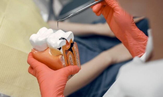 Root Canal Treatment Dentist in gloved hands holding dental model showing tooth structure and gum tissue during patient consultation.