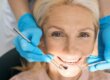 Dental Crowns Scottsdale