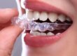 Invisalign in Scottsdale