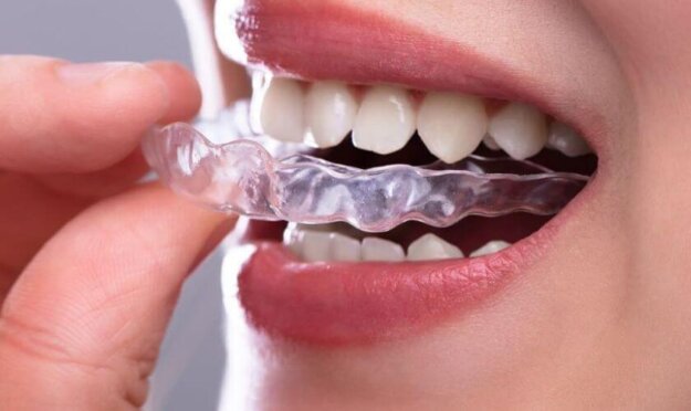 Invisalign in Scottsdale