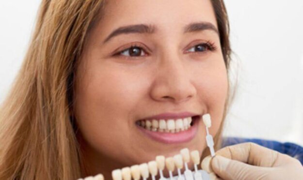 Veneers Scottsdale