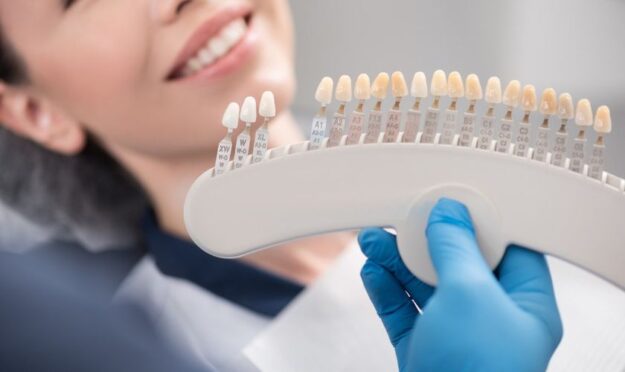 Veneers in Scottsdale
