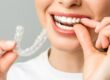 Invisalign in Scottsdale