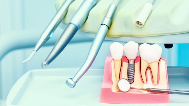 Regain Your Smile and Confidence with Dental Implants in Scottsdale Regain Your Smile and Confidence with Dental Implants in Scottsdale