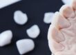 Dental veneers in Scottsdale: Unveiling Your Dream Smile