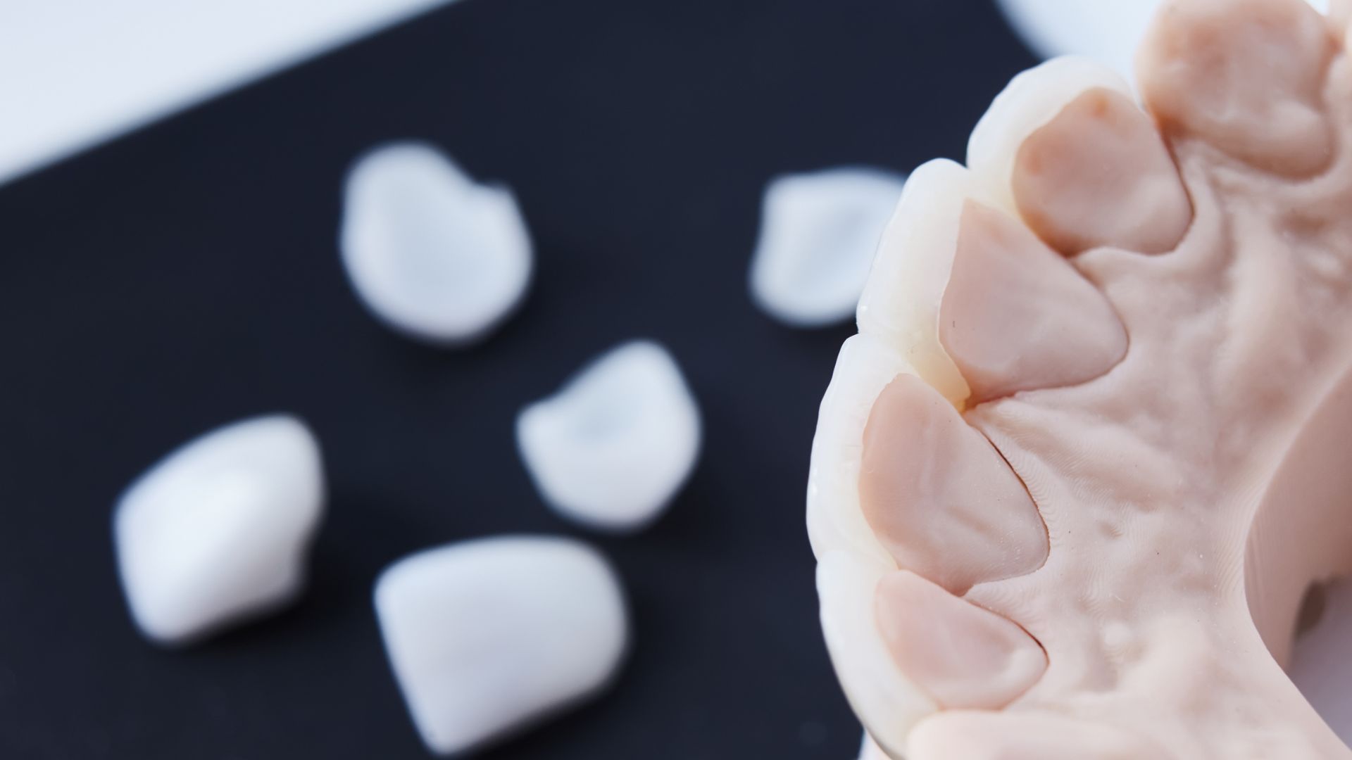 Dental veneers in Scottsdale: Unveiling Your Dream Smile