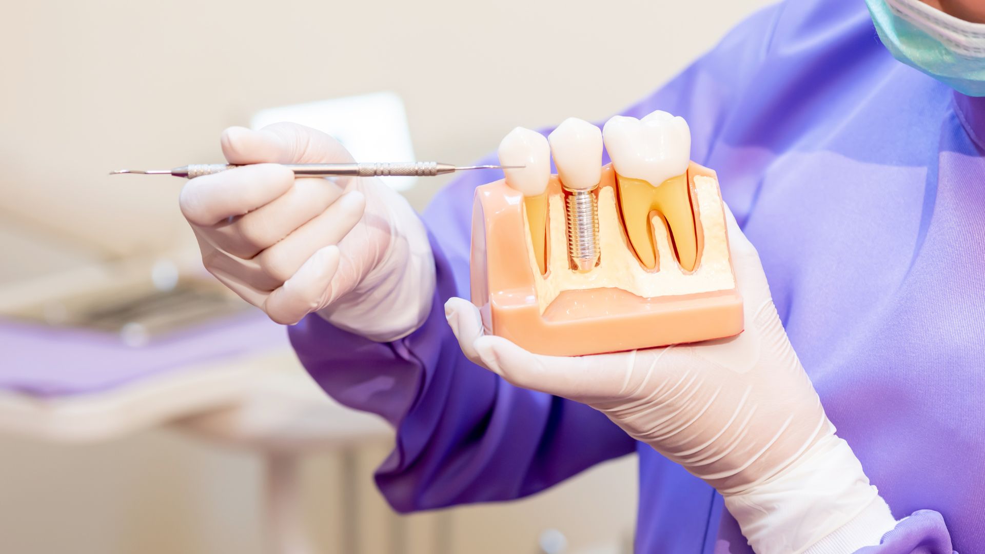 Am I A Good Candidate For Dental Implants in Scottsdale?