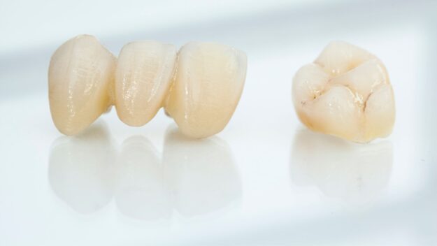 Dental Crowns Dental Crowns