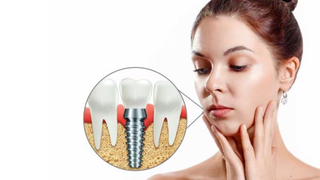 Painless Dental Implant Solutions in Scottsdale Painless Dental Implant Solutions in Scottsdale