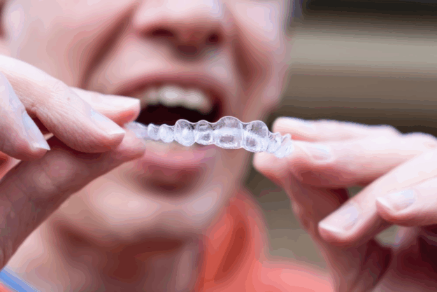 Gum Irritation from Invisalign? Causes & Relief Tips from Scottsdale Team