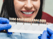 Do Veneers Damage Your Teeth? Know from Our Cosmetic Dentist in Scottsdale, AZ