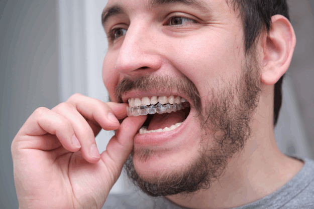 Can You Eat Normally with Invisalign? Know from our Scottsdale Team