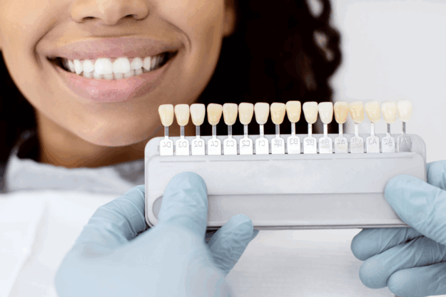 How Long Do Veneers Last? Lifespan & Care Tips from Our Cosmetic Dentist in Scottsdale How Long Do Veneers Last? Lifespan & Care Tips from Our Cosmetic Dentist in Scottsdale