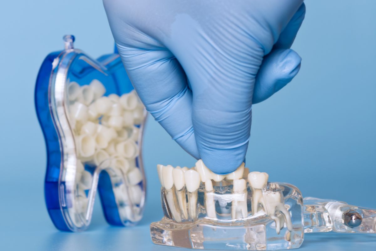 Dental Crowns Scottsdale