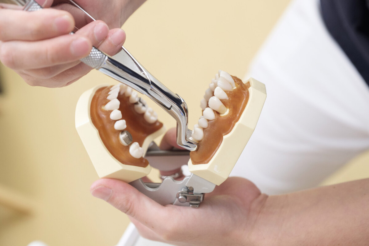 Tooth Extraction in Scottsdale