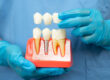 Dental Implants Scottsdale