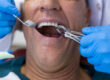 Tooth Extractions Scottsdale