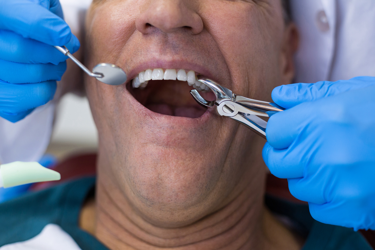 Tooth Extractions Scottsdale