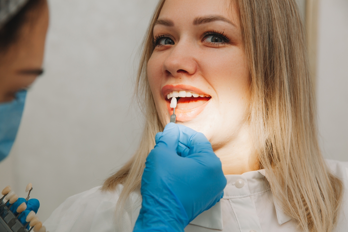 Dental Veneers Scottsdale