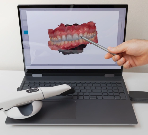 Dental professional using a digital scanner to take impressions representing digital impression technology in Scottsdale