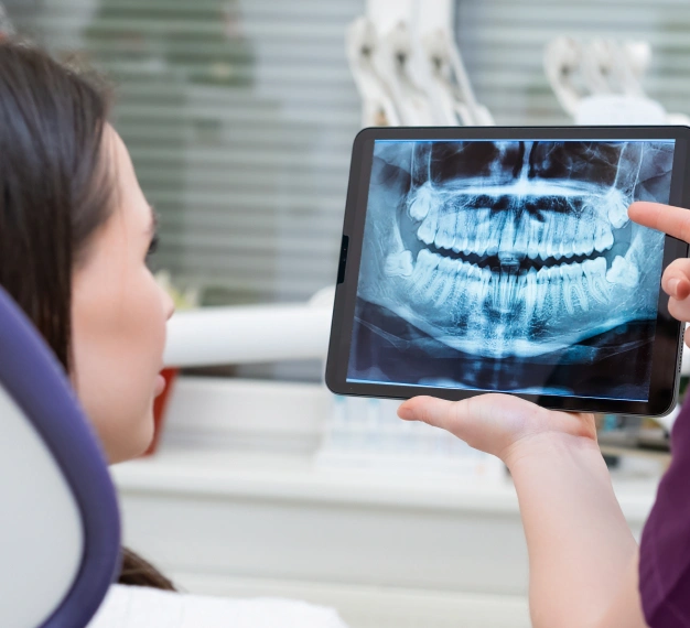 Dental professional reviewing digital x rays on a tablet representing digital x ray technology at Dentistry of Old Town Scottsdale