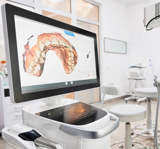 3D dental scan on a large monitor representing advanced dental technology at Dentistry of Old Town Scottsdale