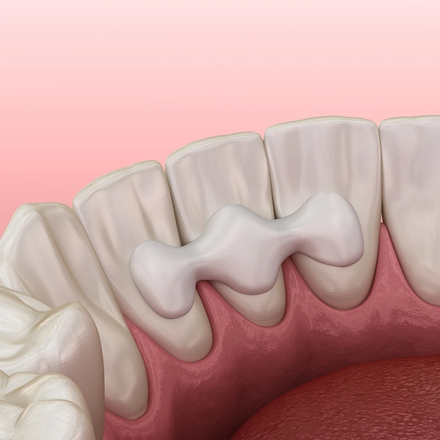 Pink background with dental gloves representing periodontal splinting treatment at Dentistry of Old Town Scottsdale