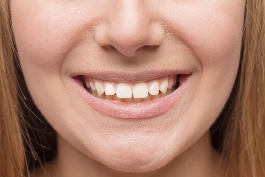 Cosmetic dental bonding used to repair a gap between front tooth