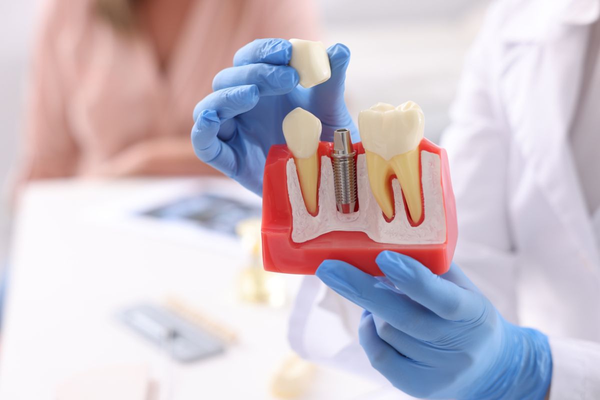 Dental professional holding a model showing an implant post and crown restoration in Scottsdale